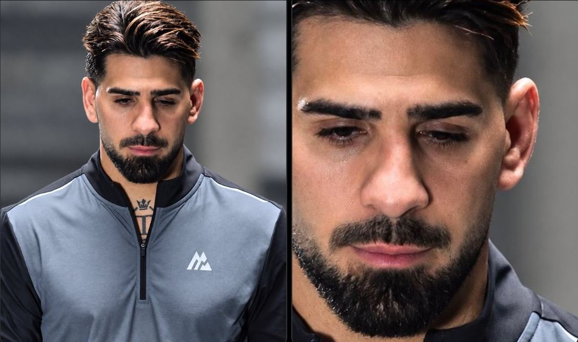 Ilia Topuria, l’occhio sinistro non si apre: il dramma dopo UFC 250